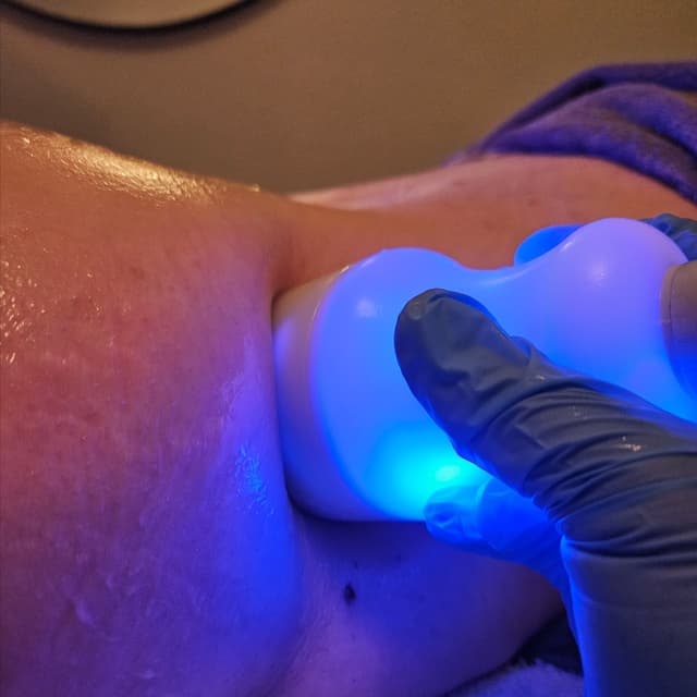 7 Cryo Slimming at Seal Beach Massage & Wellness in Seal Beach, CA