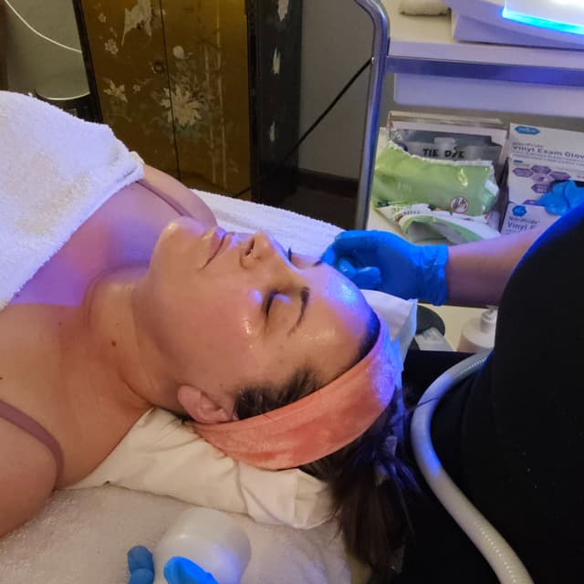 5 Cryo Chin Slim at Seal Beach Massage & Wellness in Seal Beach, CA